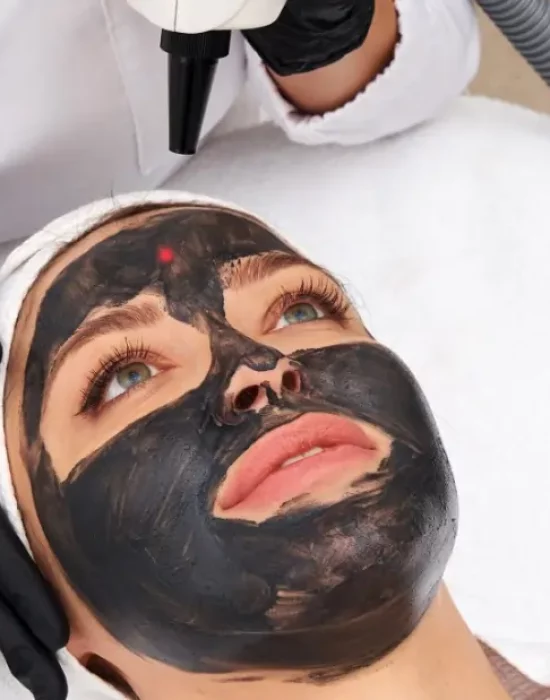 carbon-hollywood-peeling-kosmetikstudio-mannheim-kosmetiklounge.webp
