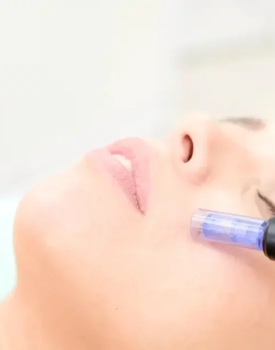 microneedling-micro-needling-facial-kosmetik-kosmetikstudio-weil-am-rhein-bb-beauty-schonheitssalon